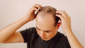 7 Everyday Foods That May Reduce Hair Fall — Nutritionist-Friendly Picks