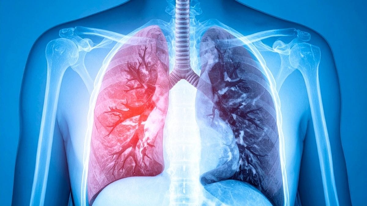 Are Your Lungs Aging Faster Than You? 7 Signs You Shouldn’t Ignore