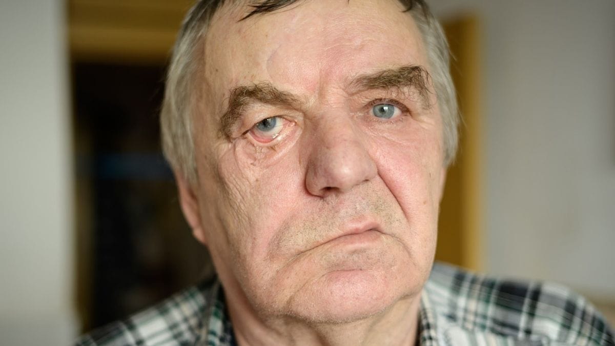 How to Recognize a Stroke in the First 60 Seconds (And Act Fast)