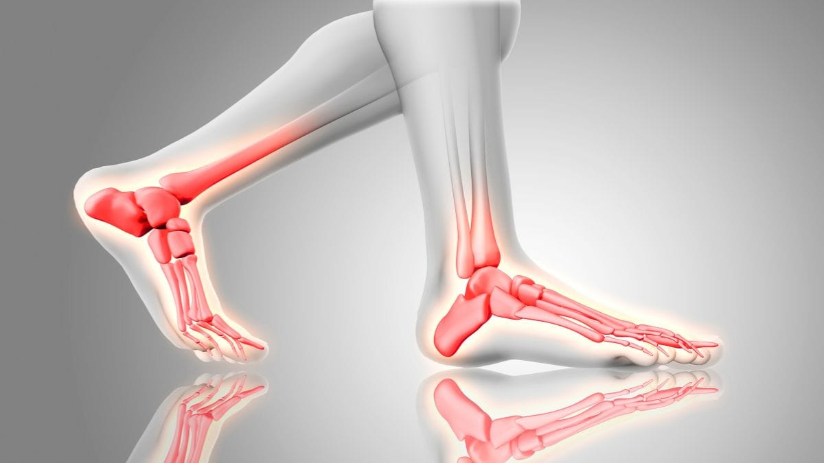 Top 3 Fruits for Strong Bones (Will Shock You #3!)